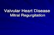Valvular Heart Disease Mitral Regurgitation · Stage 1-compensated: –End-diastolic dimension less 63mm, ESD less 42mm –EF more than 60 Stage 2-transitional –EDD 65-68mm, ESD