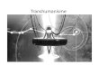 Th iTranshumanisme - Nicki Hansennickithansen.dk/_studies/y3s1_digikult2.pdf · • Cyborg building – Blanding af menneske og maskine – Vi bliver selv den næste art. Definition