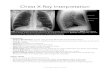 Chest X-Ray 2andrewmbaker.com/medical-resources/files/Chest-X-Ray-Interpretation.pdfChest X-Ray Interpretation Framework -Patient Identiﬁcation: Is it the right patient?What date