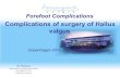 Complications of surgery of Hallux valgusComplications of surgery of Hallux valgus Barouk L S, Forefoot Reconstruction Hallux valgus correction using transarticular lateral release