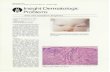 Dermatology North Palm Beach – Dr. Kaminester, M.D ... · reaction to these zits, pimples, and cysts. Many budding per- sonalities are permanently marred by the psychologic trau-
