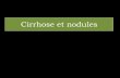 New Cirrhose et nodules - ONCLE PAULonclepaul.net/wp-content/uploads/2011/07/foie-5... · 2013. 2. 11. · Cirrhose macro-nodulaire: nodule 3 mm Nodules difficilement individualisables