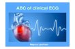 ABC of clinical ECG · • The PQ interval Normal ECG intervalls starts at the beginning of the atrial contraction and ends at the beginning of the ventricular contraction (0,12 –