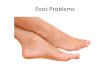 Foot Problems - pdfs.semanticscholar.org€¦ · • Plantar Fasciitis • Bunions and Hammertoes ... •Soft •Low heel Metatarsal supports Cortisone injections . Treatment: Conservative
