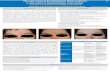 a case report of granulomatous acne rosacea · 1. Khokhar, O. & Khachemoune, A. A case of granulomatous rosacea: Sorting granulomatous rosacea from other granulomatous diseases that