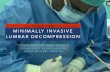 WHY & HOW MINIMALLY INVASIVE LUMBAR DECOMPRESSION · Bilateral lumbar decompression via unilateral approach - clinical outcome - • satisfactory surgical outcomes with a minimum