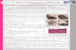 Pyoderma Gangrenosum du sein : complication post ...senologie.tv/pdf/posters/5a1fc1b4a8b25.pdf · Pyoderma Gangrenosum du sein : complication post-opératoire rare d’un syndrome