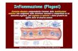 Infiammazione · Infiammazione Acuta (Robbins and Cotran Pathologic Basis of Diseases, 7th edition, 2005) Risposta immediata, aspecifica dei tessuti all ’azione delle cause flogogene