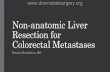 Non-anatomic Liver Resection for Colorectal Metastases Liver...2006/01/17  · Overview • Liver anatomy and hepatic resection terminology • Colorectal liver metastases Incidence