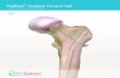 PediNail™ Pediatric Femoral Nail · bone grafting, supracondylar femur fractures, bone lengthening and shortening, fixation of fractures that occur in and between the proximal and