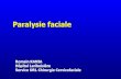 Aucun titre de diapositivedcem1p7.free.fr/ORL/Paralysiefaciale.pdf · 2009. 1. 30. · Paralysie faciale Romain KANIA Hôpital Lariboisière ... douloureuse sensitifsensitif ... Différentiel
