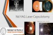 Nd:YAG Laser Capsulotomy · 2020. 11. 5. · •“5 Year Incidence of YAG Capsulotomy and PCO after Cataract Surgery with Single-Piece Monofocal Intraocular Lenses: a Real-World