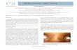 A Multitrabecular Nasal Dermoid Cyst: Case Report...1. Denoyela F (1997) Nasal dermoid sinus cyst in children. Laryngoscope 107: 795-800. 2. Rohrich RJ, Lwe JB and schwart MR (1999)