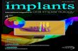 issn 1868-3207 Vol. 12 Issue 4/2011 implants · 2021. 1. 9. · Implants_2_11_V001.indd 1 12.04.2011 12:02:27. I clinical study _ flapless implant surgery 08I implants 4_2011 A positive