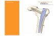 Surgical Technique - Smith & Nephew...5 Implant specifications Note These views are not to scale and should be used as a pictorial representation only. TRIGEN INTERTAN nail (long)