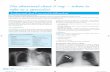 The abnormal chest X-ray – when to refer to a specialis t