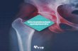 Informatiebrochure spondyloartritis