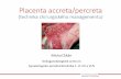 Placenta accreta/percreta - lekaridnes.cz