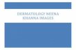 dermatology neena khanna images - 1 File Download