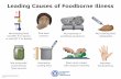 Leading Causes of Foodborne Illness