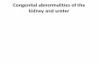 Congenital abnormalities of the kidney and ureter