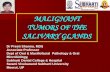 MALIGNANT TUMORS OF THE SALIVARY GLANDS
