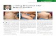Getting Truculent with Truncal Rashes