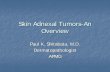Skin Adnexal Tumors-An Overview - The Doctor's Doctor