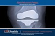 Knee Replacement Surgery - Maximizing Your New Knee(s)