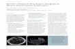 Review: Magnetic Resonance Imaging of Muscle Denervation ...