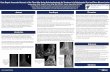 Case Report: Avascular Necrosis of the Talus After Using ...