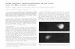 Case Reports: Nonvisualization of the Liver with Tc-99m ...