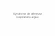 Syndrome detresse respiratoire aigue