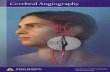 Diagnostic Cerebral Angiography - Johns Hopkins Medicine