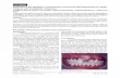 Impaction of the Maxillary Central Incisor Associated with Supernumerary Tooth: Surgical and Orthodontic Treatment