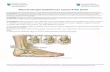 Physical Therapy Guidelines for Lateral Ankle Sprain