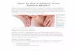 How to Get Freedom From Stretch Marks?