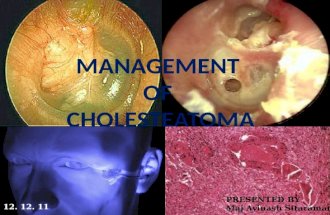 Management of Cholesteatoma