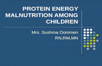Protein energy malnutrition among children