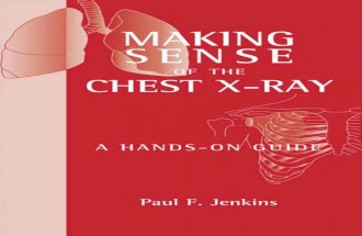 Making Sense of Chest Xray a Hands on Guide