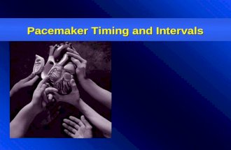 Pacemaker Timing & Intervals