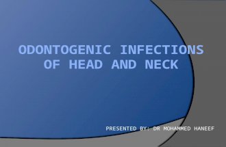 Infections of head and neck