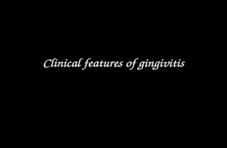 Clinical features ofgingivitis. periodontics