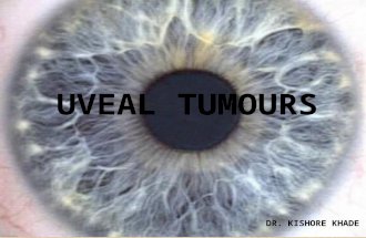 Uveal tumours