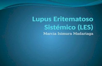 15   Lupus eritematoso sistémico