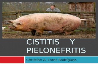 Cistitis    y Pielonefritis