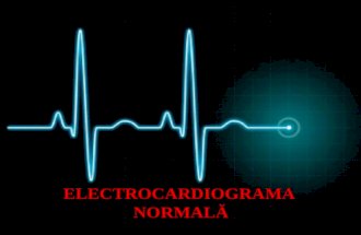 Electrocardiograma normala