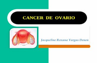 Cancer de ovario