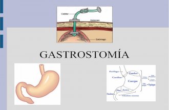 Gastrostomía: Definición, indicaciones, tipos, cuidados y complicaciones.