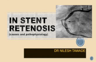 In stent retenosis pathophysiology